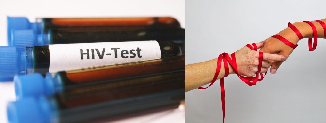AIDS ve Tedavi Seçenekleri: Bugünün Durumu ve Geleceği