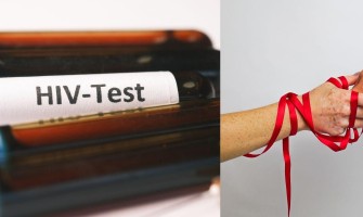 AIDS ve Tedavi Seçenekleri: Bugünün Durumu ve Geleceği