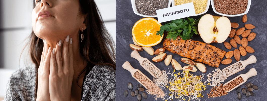 Hashimoto Tiroiditi: Belirtiler, Tanı ve Tedavi