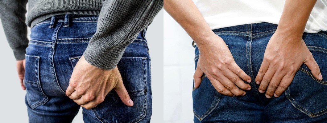 Hemeroid ve Tedavisi Hemeroid ve Tedavisi