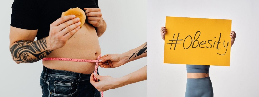 Obezite: İnsanlığın karşılaştığı büyük bela Obezite: İnsanlığın karşılaştığı büyük bela